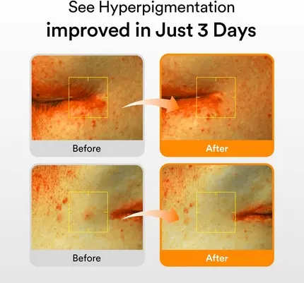Vitamin Serum Abib Glutathiosome Dark Spot Serum Vita Drop