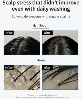 Scalp Scaler Grow Gorgeous